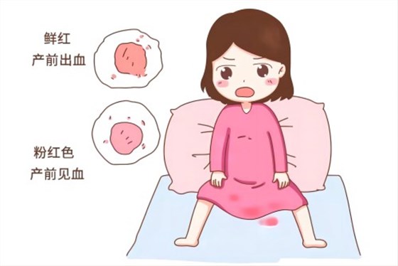 產(chǎn)后出血 產(chǎn)后出血